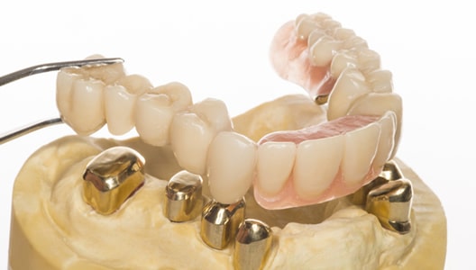 protesi dentarie venezia