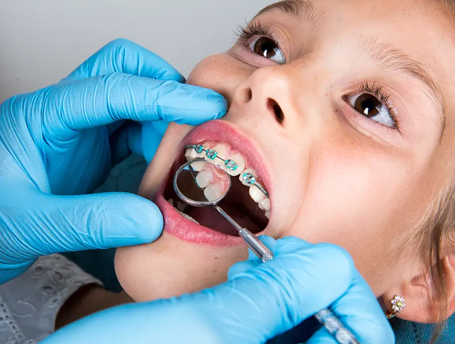 impianti dentali per bambini - apparecchio per bambini